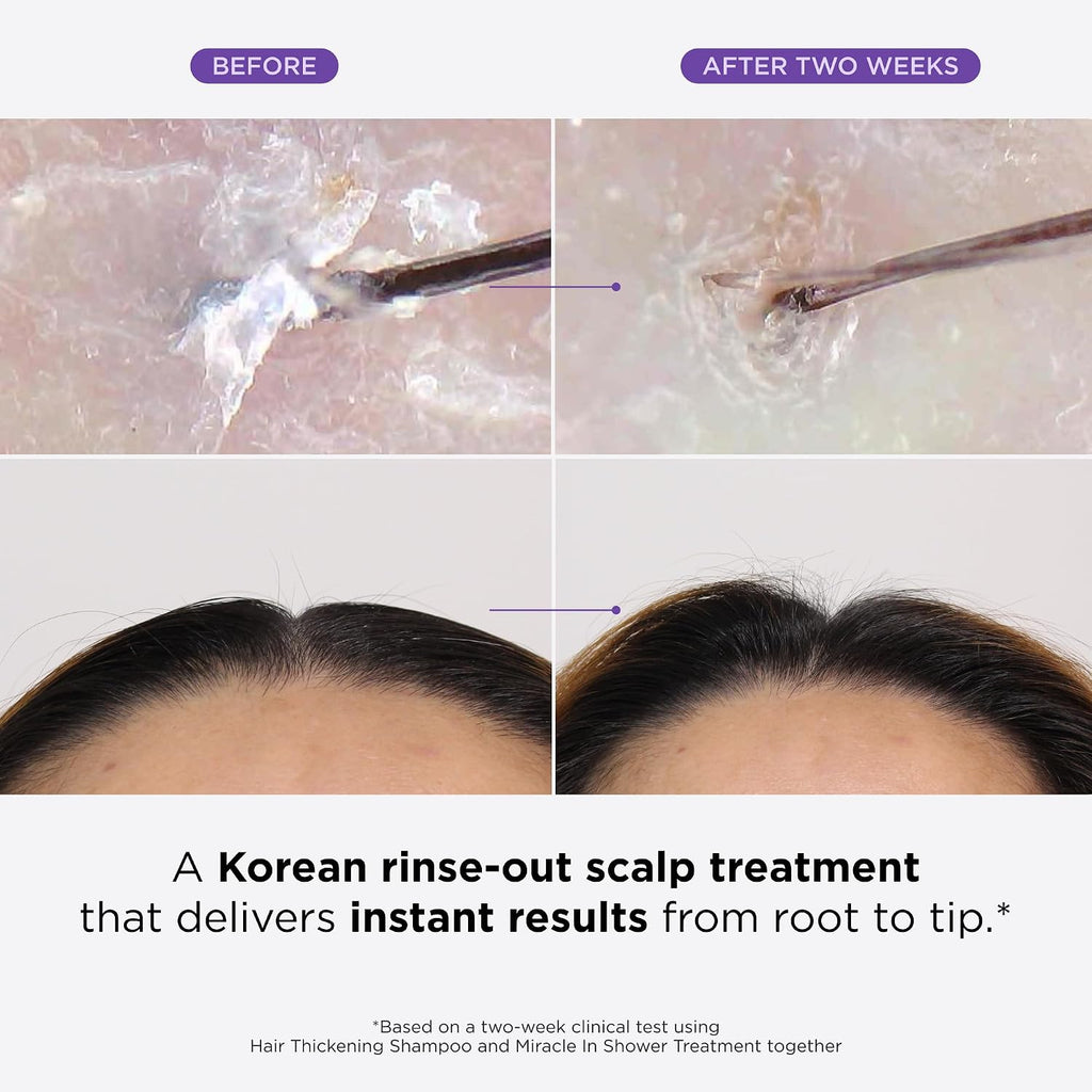 Thickening Shampoo & Scalp Treatment Set for Hair Loss – Clinical Results with Biotin and Rosemary for Hair Thinning, Shedding, Scalp Repair and Treatment