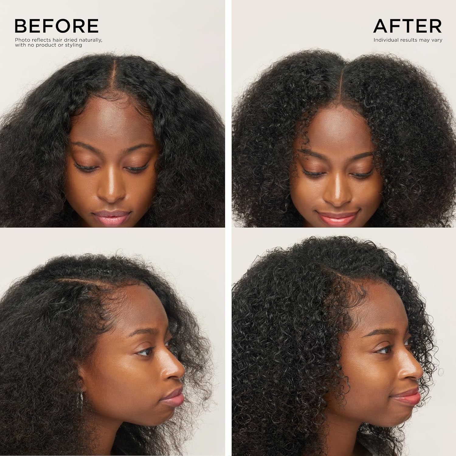Thickening Shampoo & Scalp Treatment Set for Hair Loss – Clinical Results with Biotin and Rosemary for Hair Thinning, Shedding, Scalp Repair and Treatment