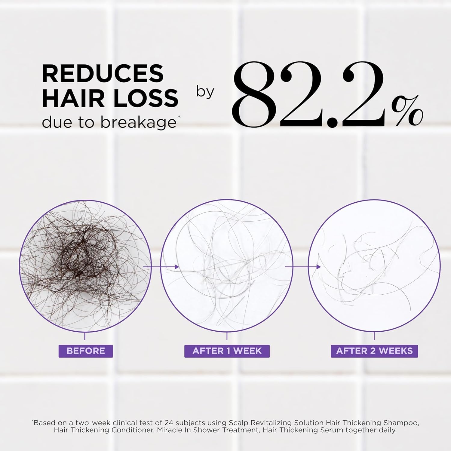 Thickening Shampoo & Conditioner Set for Hair Loss – Clinical Results with Biotin and Rosemary for Hair Thinning, Shedding, Scalp Repair and Treatment